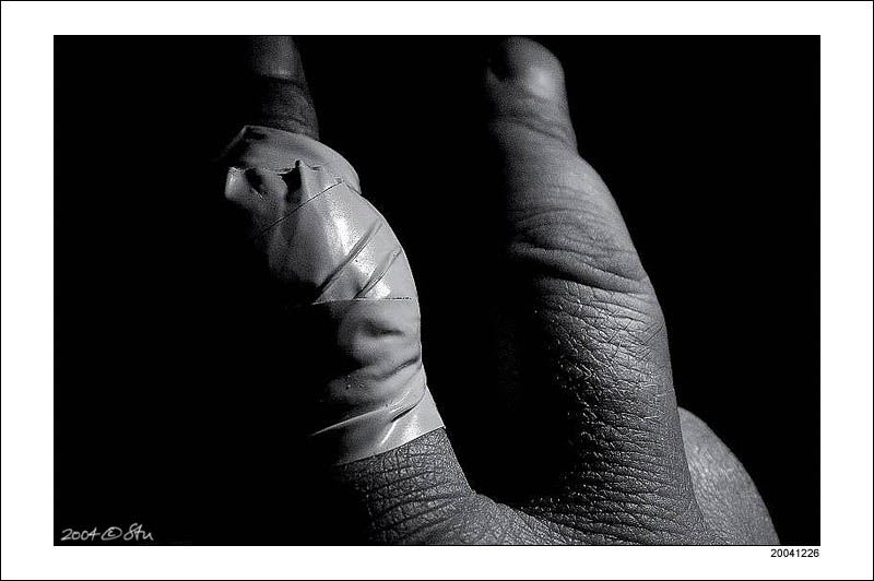 Sore finger