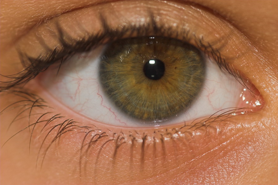Paola eye