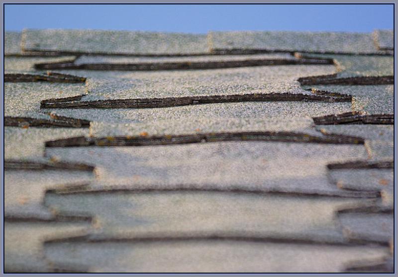 Shingles  *