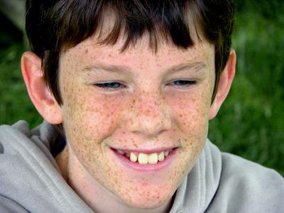 v3/43/182343/3/45179200.FrecklesNet.jpg