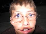 FishEyedBoney