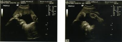 Keeley 33 weeks.jpg