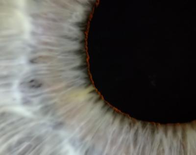 Eye