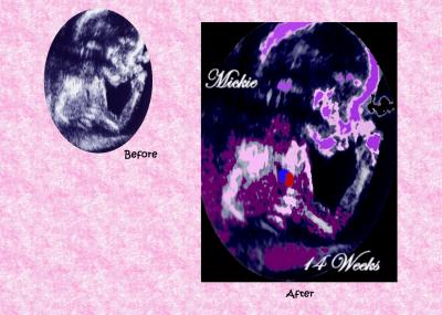 Ashley befor and After.jpg