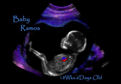 v3/69/475669/3/48172667.babyramos4mpix.jpg