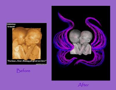 angle twins before and after
