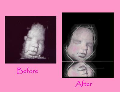 baby grayson w hood Before and after.jpg