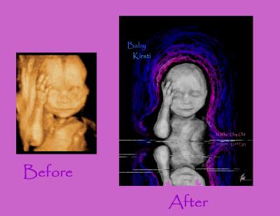 Baby Kirsti... Before and After .