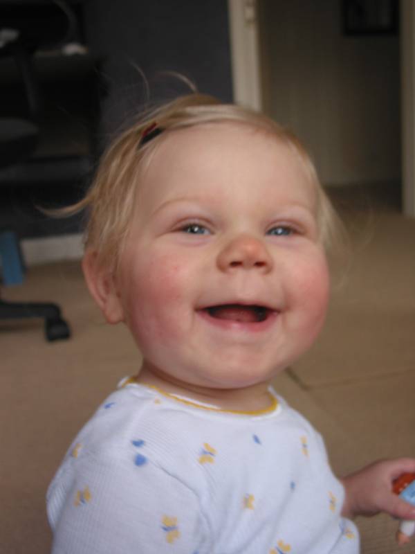 killer grin