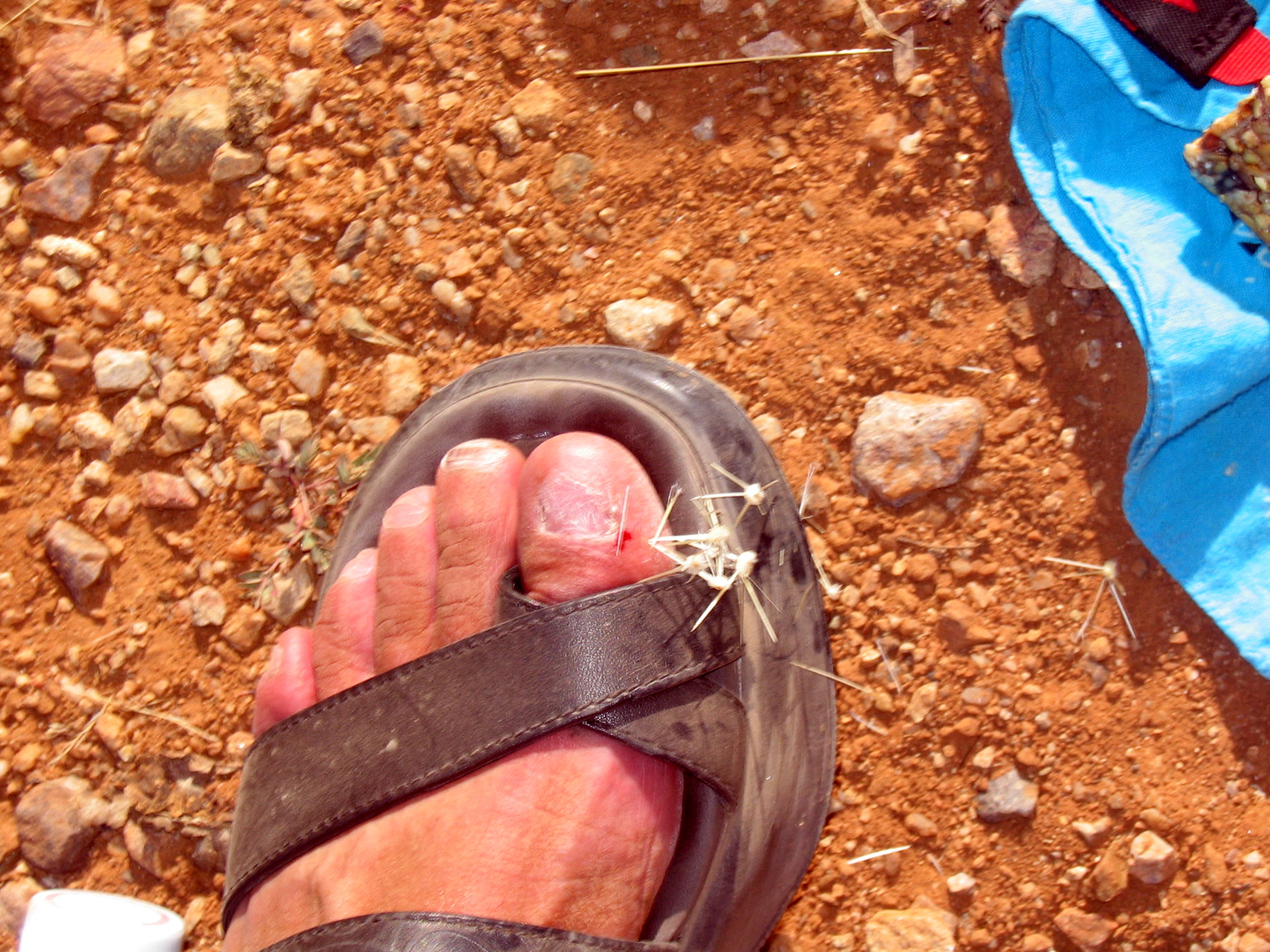 What was I thinking!  (this is AFTER Anita and I somehow managed to get the cactus out of my foot)