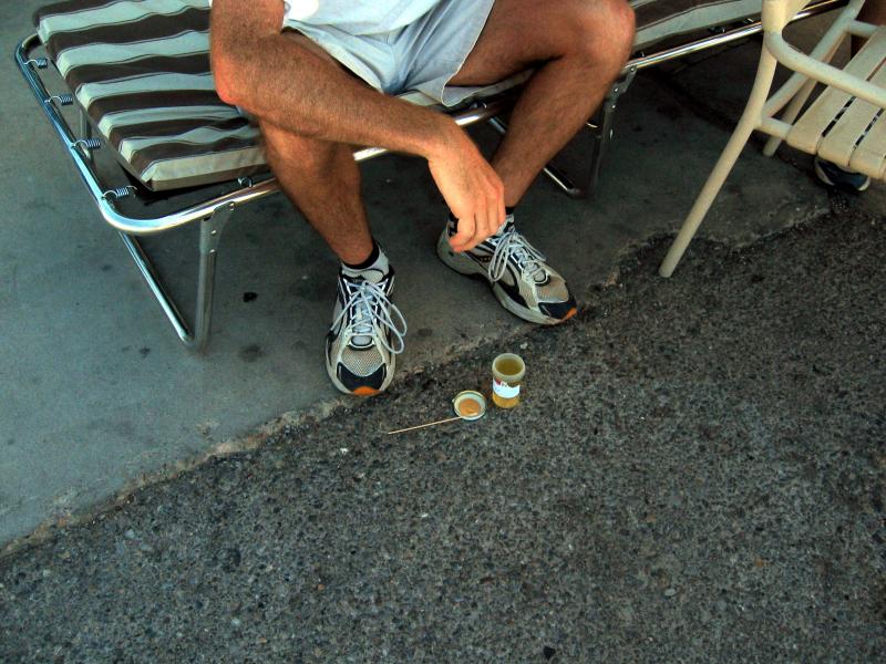 Runner volunteers collected urine in containers. Urine output and specific gravity (a measure of hydration) was recorded.