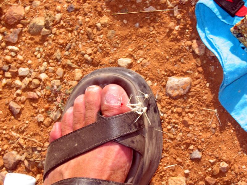 What was I thinking!  (this is AFTER Anita and I somehow managed to get the cactus out of my foot)