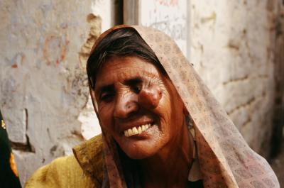 Bhuj17180018_Woman+Disease.