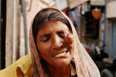 Bhuj17180019_Woman+Disease.