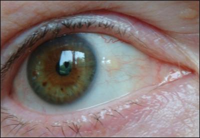 Eye Love  by Paul Fink